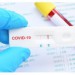 Четверть компаний по тестированию на коронавирус нарушили правила